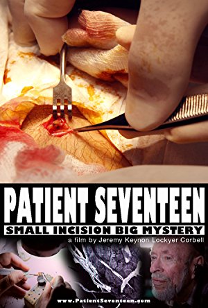 Patient Seventeen